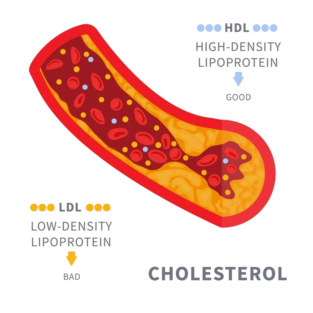 Types of Hyperlipidemia - ICD 10 for HLD