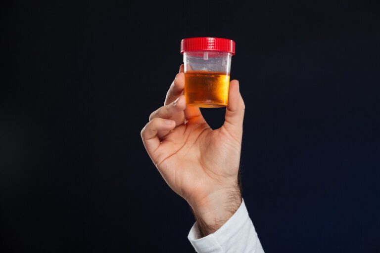 alcohol be detected in urine